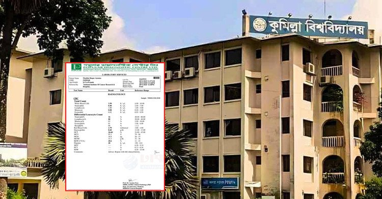 বাঁচতে চায় ব্লাড ক্যান্সারে আক্রান্ত কুবি শিক্ষার্থী অনন্যা